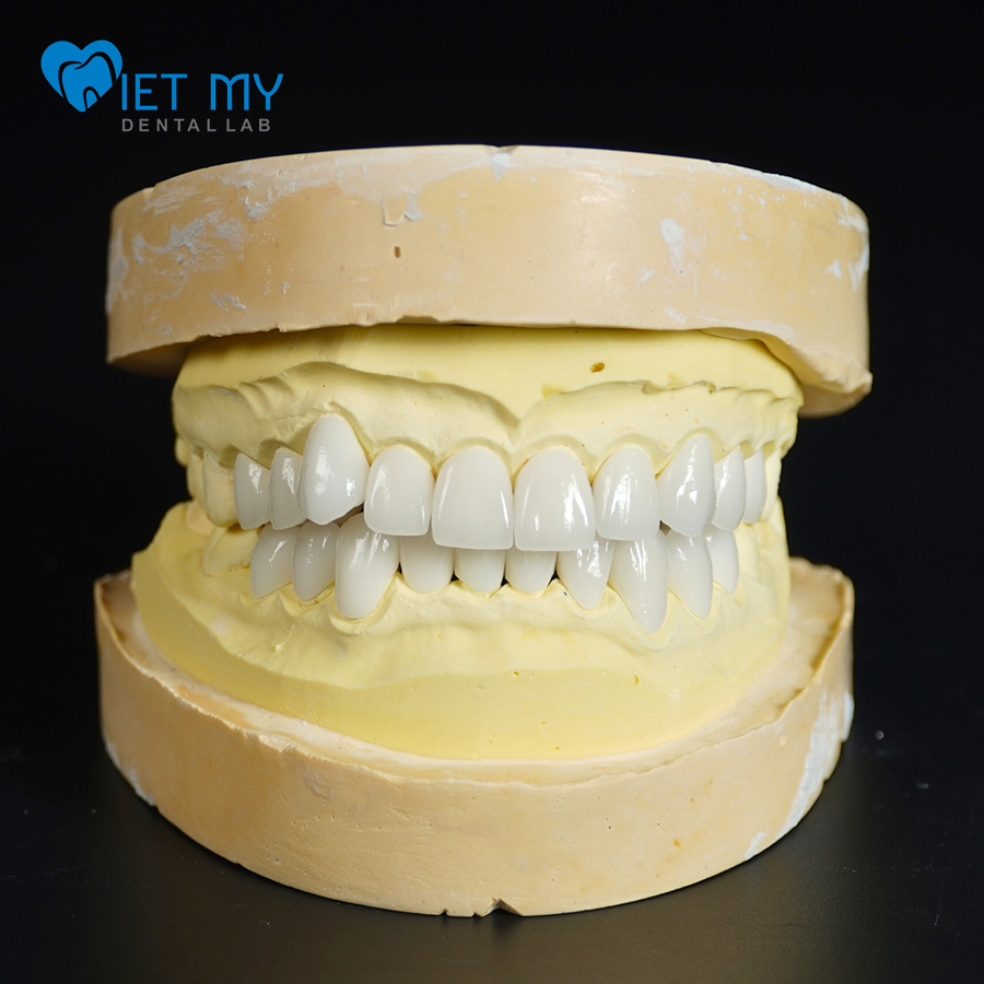 Phục Hình Răng Toàn Sứ