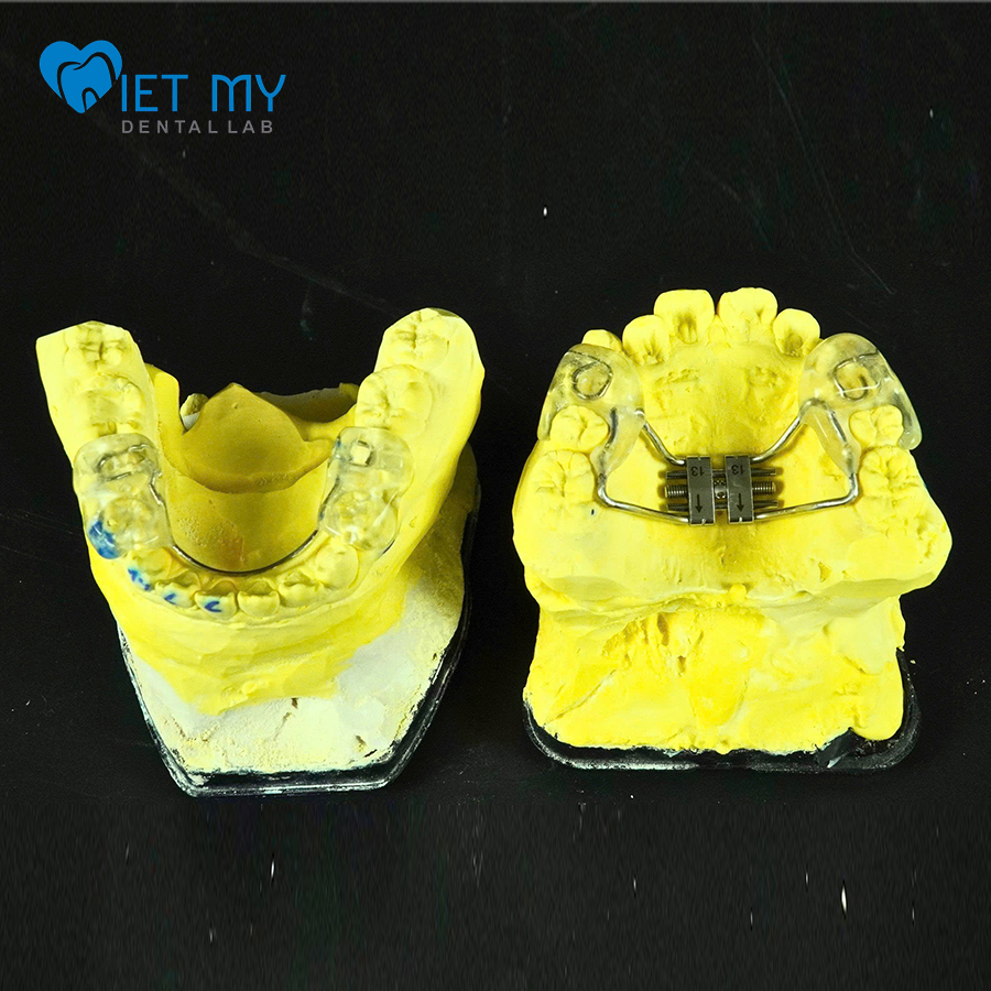 Khí Cụ Chỉnh Nha