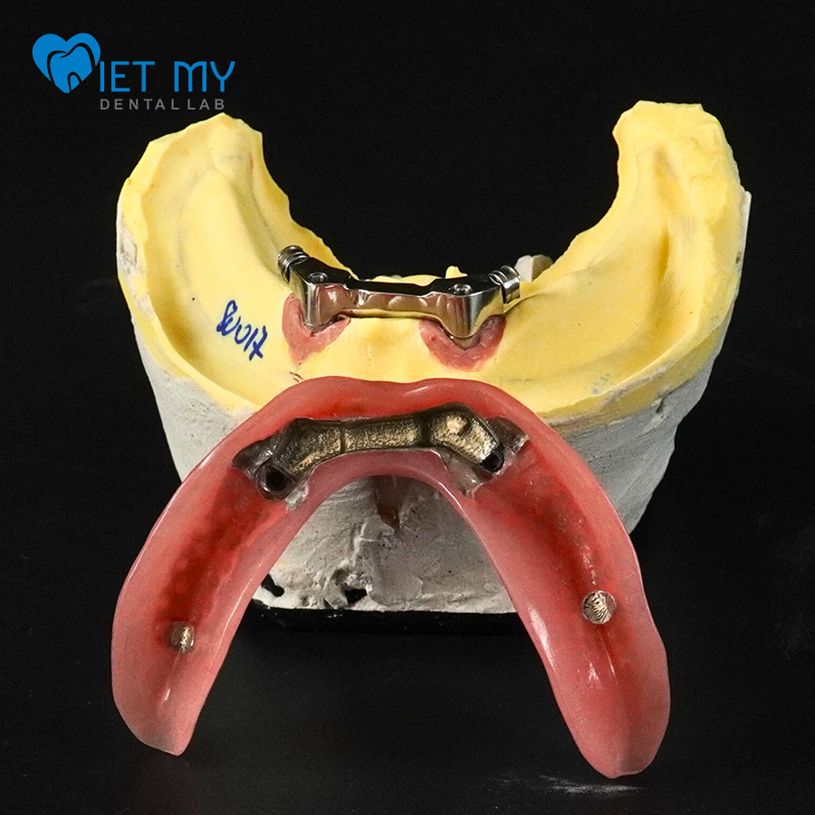 Tháo Lắp Liên Kết Rhein83